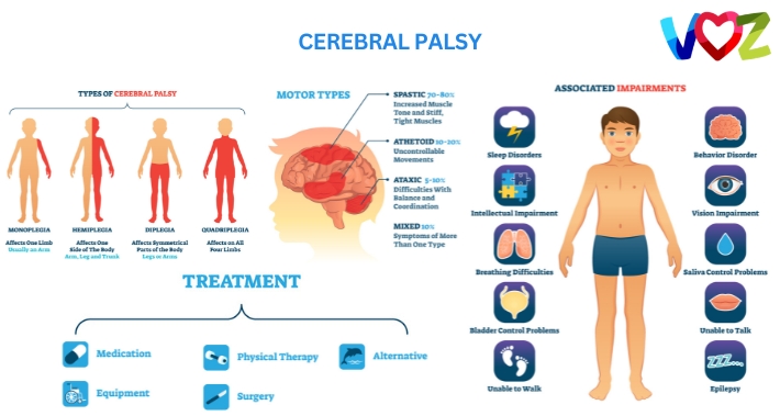 Diagram of Cerebral Palsy | The Voz Institute | Occupational Therapists in Washington DC