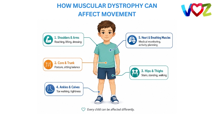 Infographic How muscular dystrophy can affect movement | The Voz Institute | Pediatric Physical Therapists in Washington DC